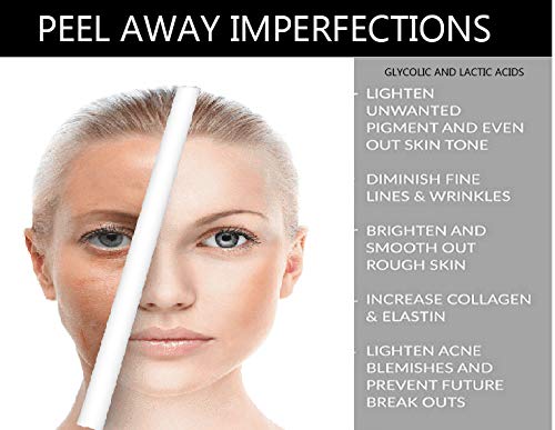 Planet Eden Youthful Glow 40% Glycolic Acid Peel with Free Fan Brush - Powerful and Deep Peel for Wrinkles, Acne and Melasma and Free Fan Brush - Image 2